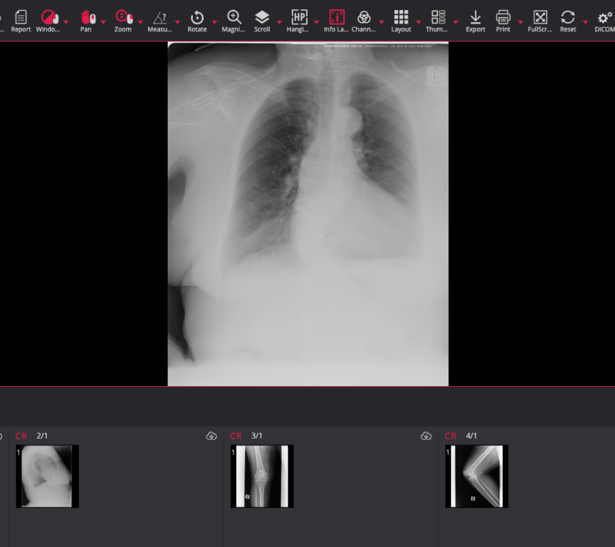 Confidential X-ray scan of chest lungs and leg along with patient details