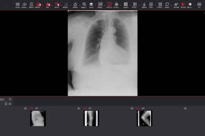 Confidential X-ray scan of chest lungs and leg along with patient details